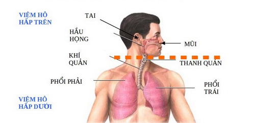 Bị nhiễm khuẩn đường hô hấp