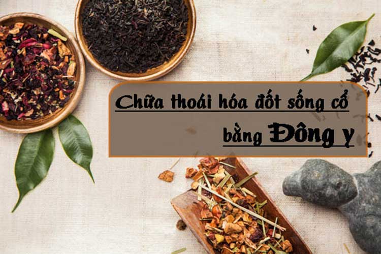 Mách bạn các bài thuốc đông y chữa thoái hóa đốt sống cổ