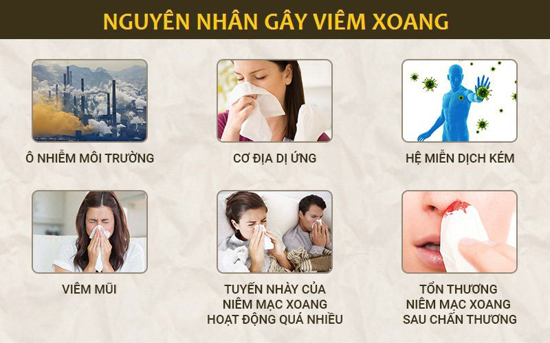 Những nguyên nhân gây viêm xoang thường gặp